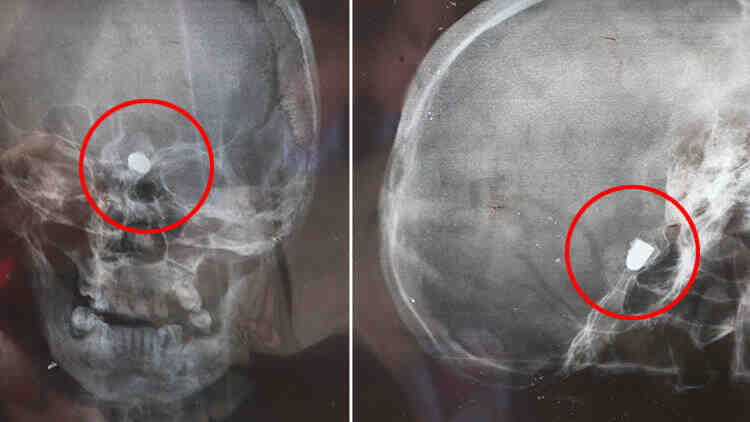 Görenler hayret ediyor… 45 yıldır bu korkuyla yaşıyor